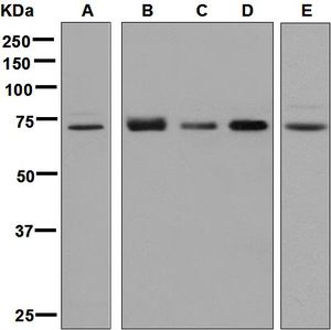 Western blot analysis on (A) HepG2, (B) K562, (C) PC-12, (D) NIH/3T3, and (E) RAW 264.7 cell lysates using anti-FUS antibody.