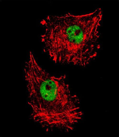 Confocal immunofluorescent of FUS Antibody with MDA-MB231 cell followed by Alexa Fluor 488-conjugated goat anti-rabbit lgG (green). Actin filaments have been labeled with Alexa Fluor 555 phalloidin (red).