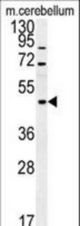 FUS Antibody western blot of mouse cerebellum tissue lysates (15 ug/lane). The FUS antibody detected FUS protein (arrow).