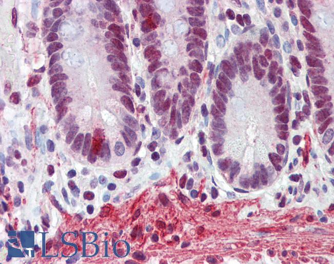 Anti-FUS antibody IHC of human small intestine. Immunohistochemistry of formalin-fixed, paraffin-embedded tissue after heat-induced antigen retrieval. Antibody LS-B3538 concentration 5 ug/ml.