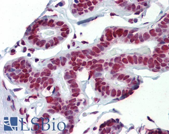 Anti-FUS antibody IHC of human breast. Immunohistochemistry of formalin-fixed, paraffin-embedded tissue after heat-induced antigen retrieval. Antibody LS-B3538 concentration 5 ug/ml.