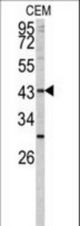 Western blot of FUT1 antibody in CEM cell line lysates (35 ug/lane). FUT1 (arrow) was detected using the purified antibody.