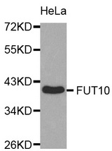 Western blot analysis of extracts of HeLa cell line, using FUT10 antibody.