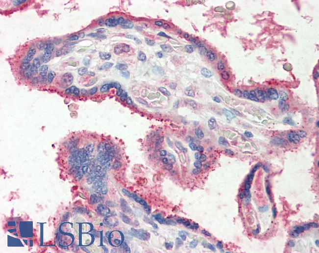 Human, Placenta: Formalin-Fixed Paraffin-Embedded (FFPE)
