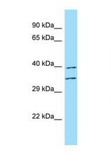 FUT3 / CD174 antibody LS-C146563 Western blot of Fetal Kidney lysate. Antibody concentration 1 ug/ml.
