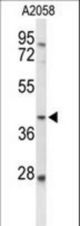 Western blot of FUT3 Antibody in A2058 cell line lysates (35 ug/lane). FUT3 (arrow) was detected using the purified antibody.