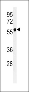 Western blot of FUT6 Antibody in HL-60 cell line lysates (35 ug/lane). FUT6 (arrow) was detected using the purified antibody.
