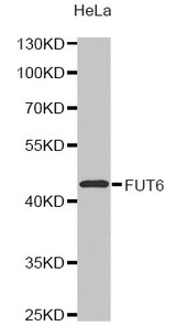Western blot analysis of extracts of HeLa cell line, using FUT6 antibody.