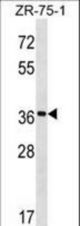 FUT7 Antibody western blot of ZR-75-1 cell line lysates (35 ug/lane). The FUT7 antibody detected the FUT7 protein (arrow).