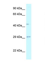 FUT8 antibody LS-C145608 Western blot of Fetal Liver lysate. Antibody concentration 1 ug/ml.