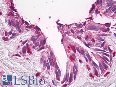 Anti-FUZ / FY antibody IHC of human lung. Immunohistochemistry of formalin-fixed, paraffin-embedded tissue after heat-induced antigen retrieval. Antibody LS-B7939 dilution 15 ug/ml.