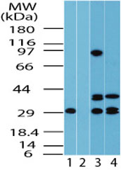 Western blot of FUZ in human lung lysate in the 1) absence and 2) presence of immunizing peptide, 3) mouse lung and 4) rat lung using LS-B7939 at 2.0 ug/ml, 2.0 ug/ml and 6.0 ug/ml respectively.