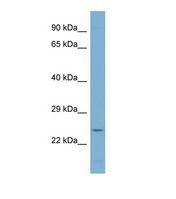 Western blot of Human PANC1 Whole cell . KDSR antibody dilution 1.0 ug/ml.