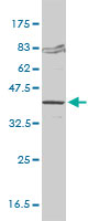 FVT1 monoclonal antibody (M01), clone 2B2-3C11 Western Blot analysis of FVT1 expression in Jurkat.