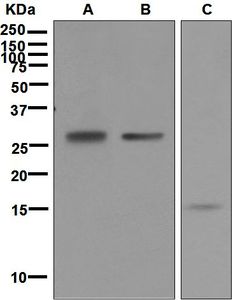 Western blot analysis on (A) human heart, (B) fetal skin, and (C) PBL lysates using anti-Frataxin antibody.