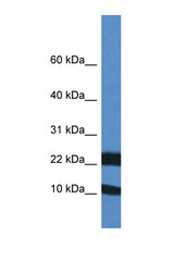 FXN / Frataxin antibody LS-C145220 Western blot of Mouse Heart lysate. Antibody concentration 1 ug/ml.