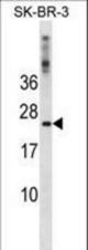 FXN Antibody western blot of SK-BR-3 cell line lysates (35 ug/lane). The FXN antibody detected the FXN protein (arrow).