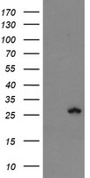 HEK293T cells were transfected with the pCMV6-ENTRY control (Left lane) or pCMV6-ENTRY FXN (Right lane) cDNA for 48 hrs and lysed. Equivalent amounts of cell lysates (5 ug per lane) were separated by SDS-PAGE and immunoblotted with anti-FXN.