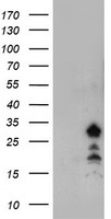 HEK293T cells were transfected with the pCMV6-ENTRY control (Left lane) or pCMV6-ENTRY FXN (Right lane) cDNA for 48 hrs and lysed. Equivalent amounts of cell lysates (5 ug per lane) were separated by SDS-PAGE and immunoblotted with anti-FXN.