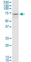 COL8A2 monoclonal antibody (M01), clone 1F4. Western Blot analysis of COL8A2 expression in K-562.