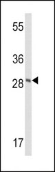Western blot of FXN Antibody in CEM cell line lysates (35 ug/lane). FXN (arrow) was detected using the purified antibody.