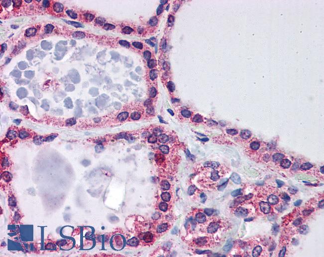 Anti-FXN / Frataxin antibody IHC of human thyroid. Immunohistochemistry of formalin-fixed, paraffin-embedded tissue after heat-induced antigen retrieval. Antibody LS-B5892 concentration 5 ug/ml.
