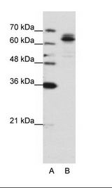 A: Marker, B: HepG2 Cell Lysate