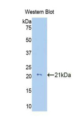 Western blot of recombinant COL8A2 / Collagen VIII.