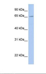 MCF7 cell lysate. Antibody concentration: 1.0 ug/ml. Gel concentration: 12%.