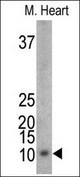 The anti-Mouse Phospho-PLM-pS88 antibody is used for detection in mouse heart tissue lysate. Mouse Phospho-PLM-pS88 (arrow) was detected using the purified antibody.