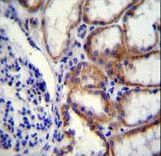 COL8A2 Antibody immunohistochemistry of formalin-fixed and paraffin-embedded human kidney tissue followed by peroxidase-conjugated secondary antibody and DAB staining.