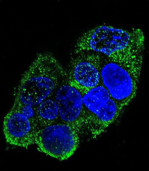 Confocal immunofluorescent of COL8A2 Antibody with HepG2 cell followed by Alexa Fluor 488-conjugated goat anti-rabbit lgG (green). DAPI was used to stain the cell nuclear (blue).
