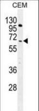COL8A2 Antibody western blot of CEM cell line lysates (35 ug/lane). The COL8A2 antibody detected the COL8A2 protein (arrow).