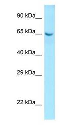 COL9A1 / Collagen IX antibody Western Blot of Fetal Small Intestine.