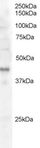 Antibody staining (0.5 ug/ml) of Jurkat lysate (RIPA buffer, 30 ug total protein per lane). Primary incubated for 1 hour. Detected by Western blot of chemiluminescence.