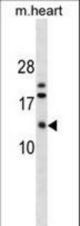 FXYD7 Antibody western blot of mouse heart tissue lysates (35 ug/lane). The FXYD7 antibody detected the FXYD7 protein (arrow).