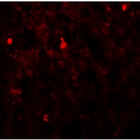 Immunofluorescence of FXYD4 in rat lung tissue with FXYD4 antibody at 20 µg/mL.