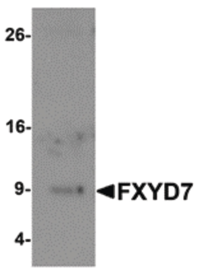 Western blot of FXYD7 in human lung tissue lysate with FXYD7 antibody at 1 ug/ml.