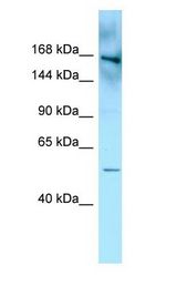 FYCO1 antibody Western Blot of MDA-MB-435S.