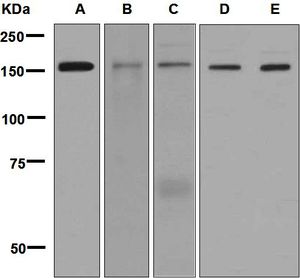 Western blot analysis on (A) HepG2, (B) fetal liver, (C) human kidney, (D) A673, and (E) Caco-2 cell lysates using anti-FYCO1 antibody.