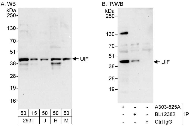 Detection of Human and Mouse UIF by Western Blot (h and m) and Immunoprecipitation (h). Samples: Whole cell lysate from 293T (15 and 50 ug for WB; 1 mg for IP, 20% of IP loaded), Jurkat (J; 50 ug), HeLa (H; 50 ug) and mouse NIH3T3 (M; 50 ug) cells. Antibodies: Affinity purified rabbit anti-UIF antibody used for WB at 0.4 ug/ml (A) and 1 ug/ml (B) and used for IP at 6 ug/mg lysate. UIF was also immunoprecipitated by rabbit anti-UIF antibody BL12382, which recognizes a downstream epitope. Detection: Chemiluminescence with exposure times of 30 seconds (A and B).