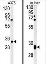 (LEFT)Western blot of FYTD1 Antibody in A375 cell line lysates (35 ug/lane). FYTD1 (arrow) was detected using the purified antibody.(RIGHT)Western blot of FYTD1 Antibody in mouse liver tissue lysates (35 ug/lane). FYTD1 (arrow) was detected using the purified antibody.