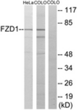 Western blot of extracts from HeLa/COLO205 cells, using FZD1 Antibody. The lane on the right is treated with the synthesized peptide.