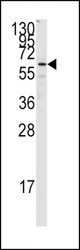 Western blot of anti-FZD1 Antibody in Jurkat cell line lysates (35 ug/lane). FZD1(arrow) was detected using the purified antibody.