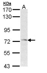 Sample (30 ug of whole cell lysate). A: Hep G2. 7.5% SDS PAGE. FZD1 antibody diluted at 1:1000.