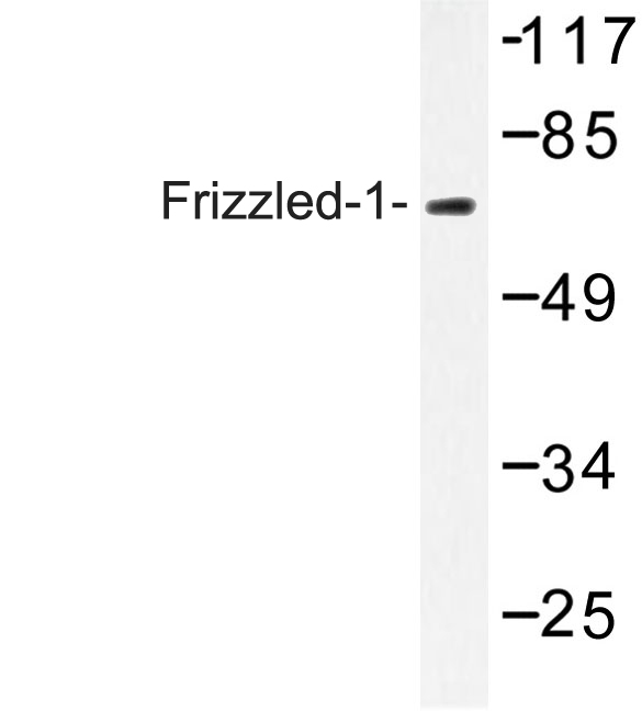 Western blot of Frizzled-1 (Q54) pAb in extracts from Jurkat cells.
