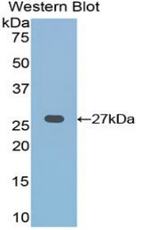 Western blot of recombinant FZD1 / Frizzled 1.