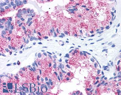 Anti-FZD1 / Frizzled 1 antibody LS-A4150 IHC of human prostate. Immunohistochemistry of formalin-fixed, paraffin-embedded tissue after heat-induced antigen retrieval.