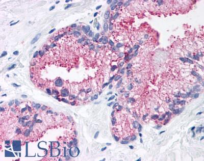 Anti-FZD1 / Frizzled 1 antibody LS-A3484 IHC of human prostate. Immunohistochemistry of formalin-fixed, paraffin-embedded tissue after heat-induced antigen retrieval.