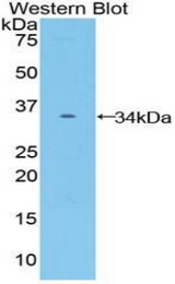 Western blot of recombinant FZD10 / Frizzled 10.